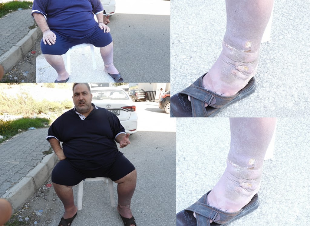 Samandağ Rotary Konteyner Kenti’nde Tahliye Kararı Mağdurları Endişelendiriyor: “SESİMİZİ DUYUN, LÜTFEN SÜREYİ UZATIN!”