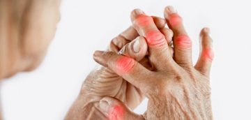 EKLEMLERDE ARTAN AĞRI, ŞİŞLİK VE SERTLİĞE DİKKAT!