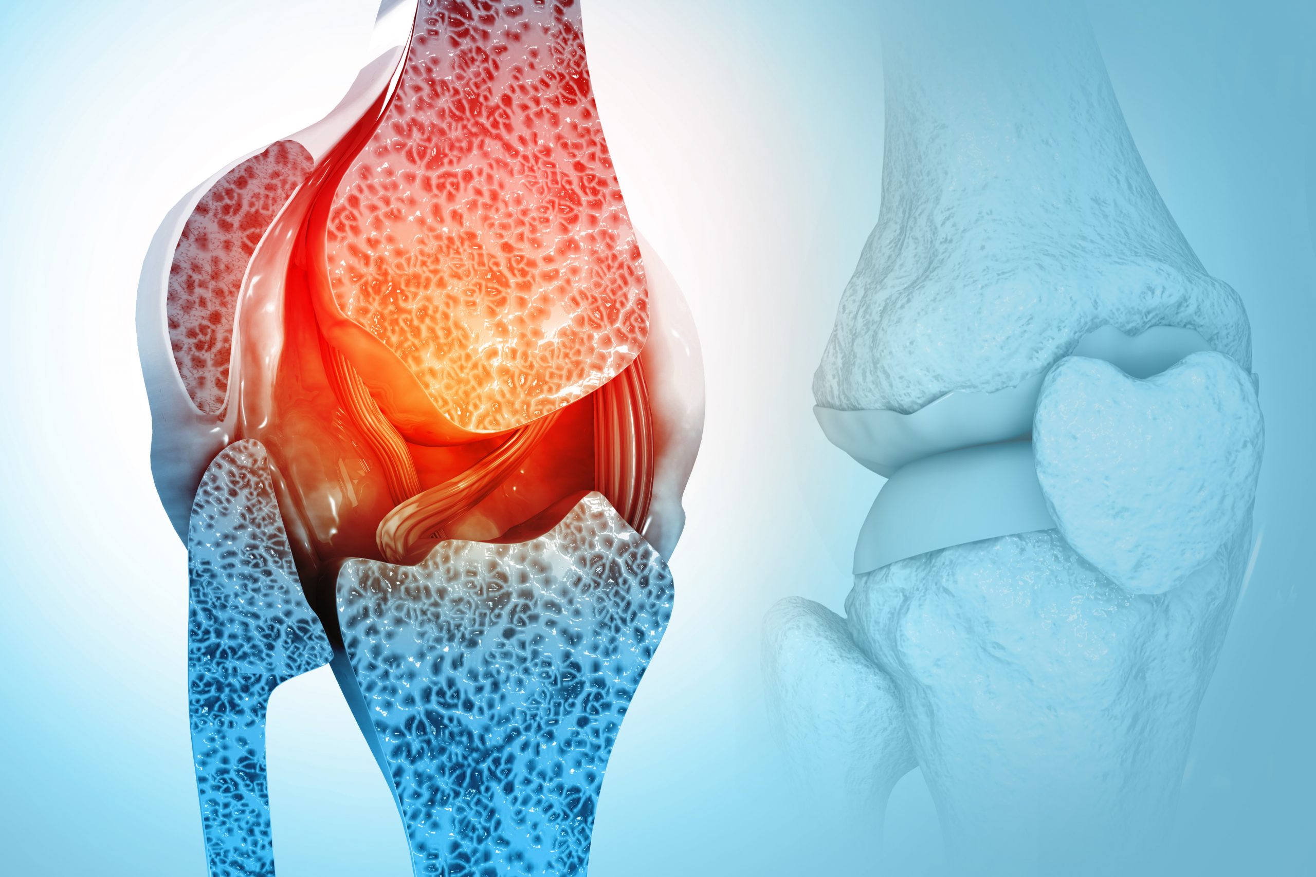 SESSİZ TEHLİKE KEMİK ERİMESİ